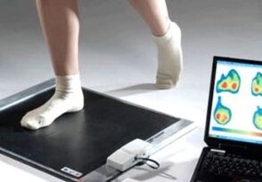 Diagnóstico de hálux valgo