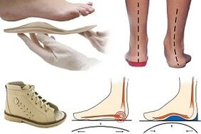 sapatos ortopédicos para hálux valgo em criança