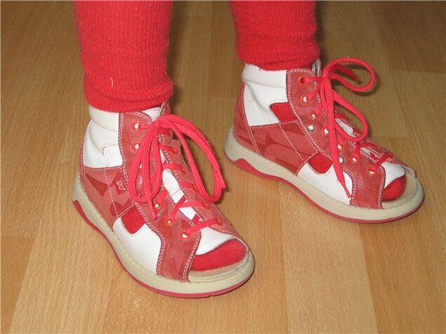 sapatos para crianças com hálux valgo